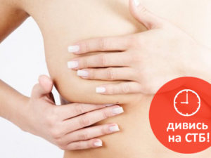 как предотвратить мастопатию