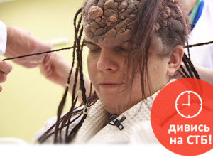 У героини проекта гниет огромное новообразование на голове