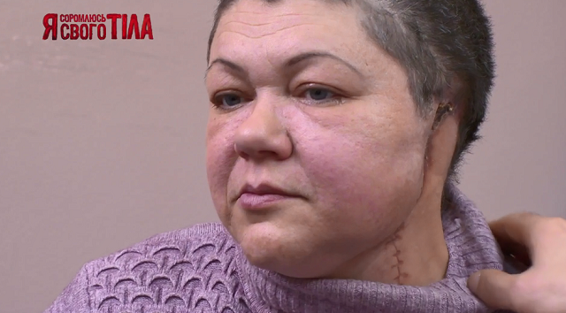 «Я соромлюсь свого тіла»-7 випуск 2: на проєкт звернулася дівчинка з сімома пальцями ясст