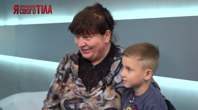 «Я соромлюсь свого тіла»-7 випуск 8: Лікарі проєкту зіткнулися з найскладнішим захворюванням за всі 7 сезонів! ясст