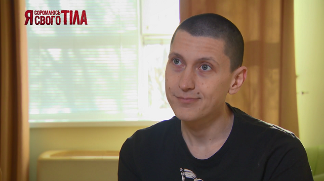 «Я соромлюсь свого тіла»-7 випуск 10: Чи вдасться лікарям допомогти дітям, які страждають на заячу губу і вовчу пащу? ясст