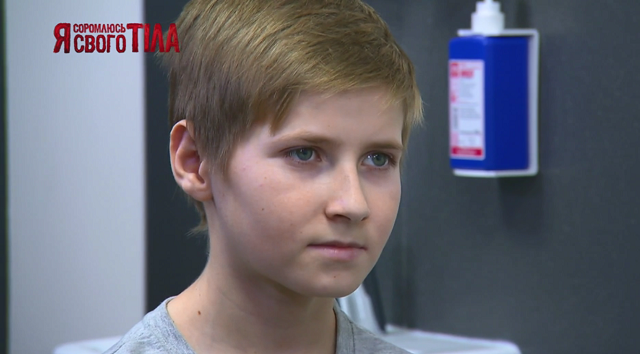 «Я соромлюсь свого тіла»-7 випуск 10: Чи вдасться лікарям допомогти дітям, які страждають на заячу губу і вовчу пащу? ясст