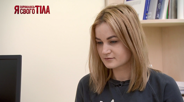 «Я соромлюсь свого тіла»-7 випуск 12: Чи вдасться лікарям проєкту допомогти дівчинці, яка страждає на вроджену деформацію щелепи? ясст