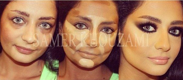25 фото, которые доказывают, что пластическая хирургия доступна всем kRQIB17cPOU