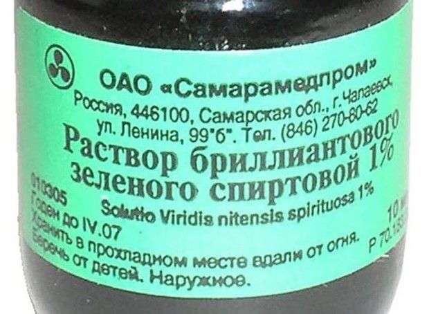 10 вещей, которые шокируют иностранцев в нашей стране 2-Зеленка