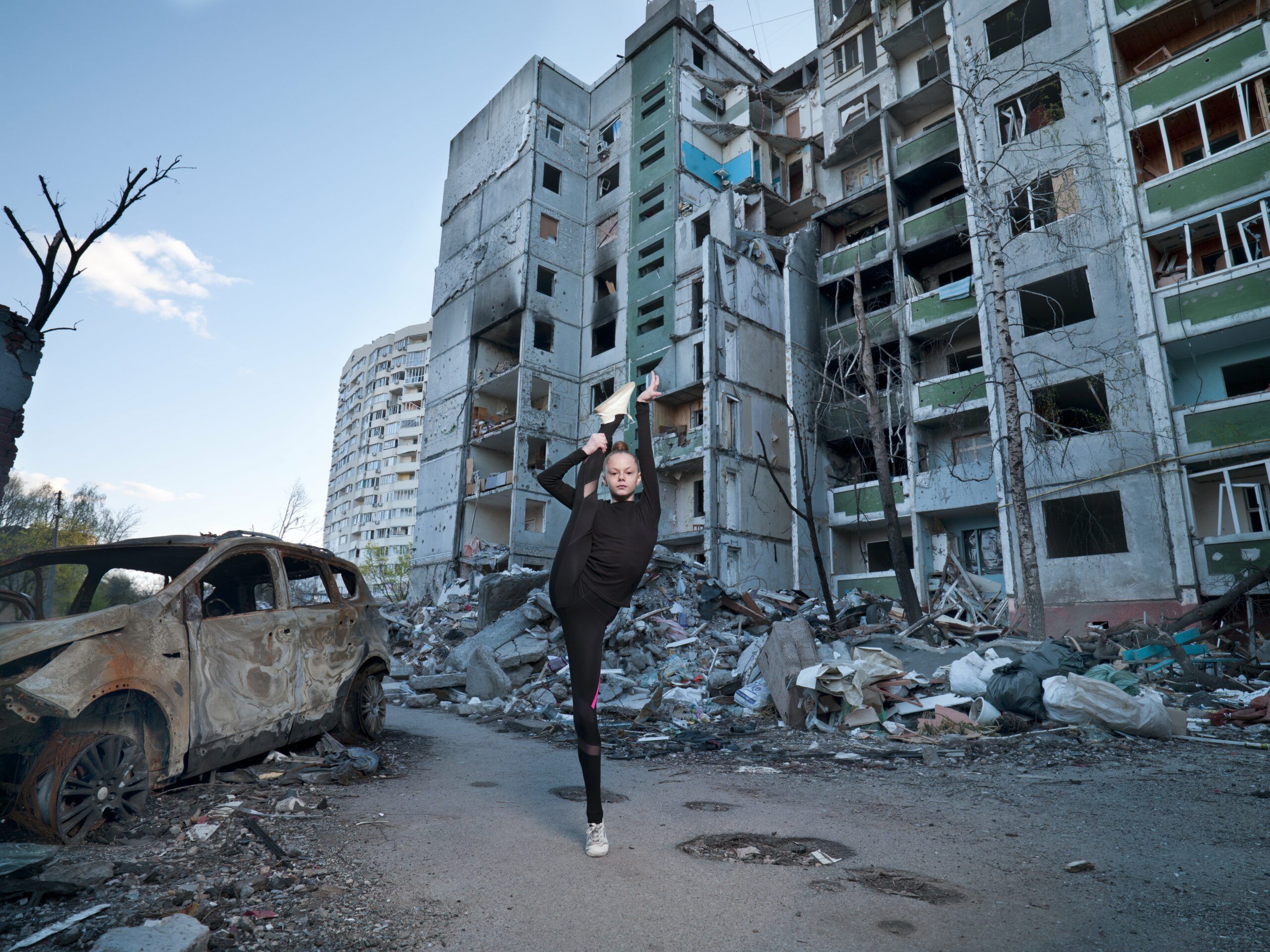 Те, що болить: у Національному музеї «Київська картинна галерея» відбудеться виставка про людей у війні У Національному музеї Київська картинна галерея відбудеться виставка Те, що болить