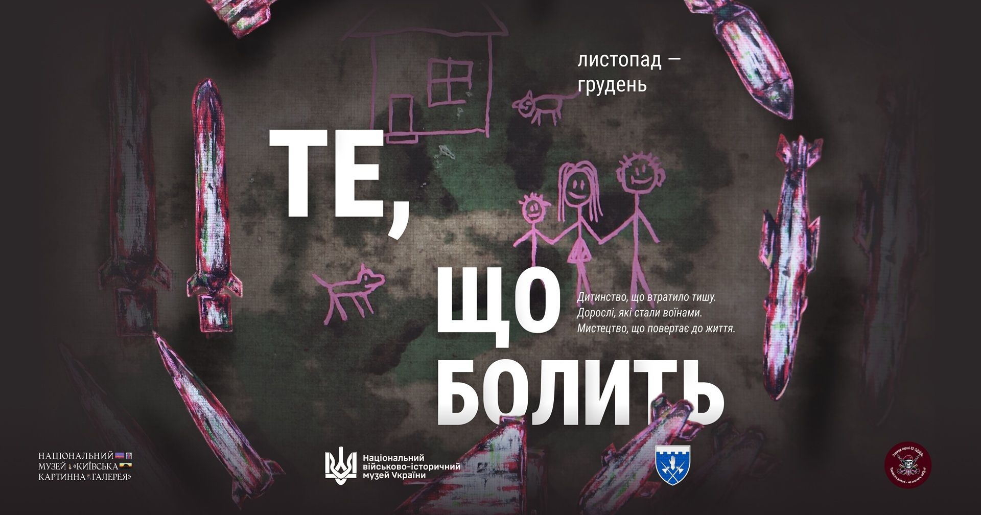Те, що болить: у Національному музеї «Київська картинна галерея» відбудеться виставка про людей у війні У Національному музеї Київська картинна галерея відбудеться виставка Те, що болить