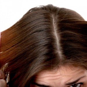 Как избавиться от перхоти