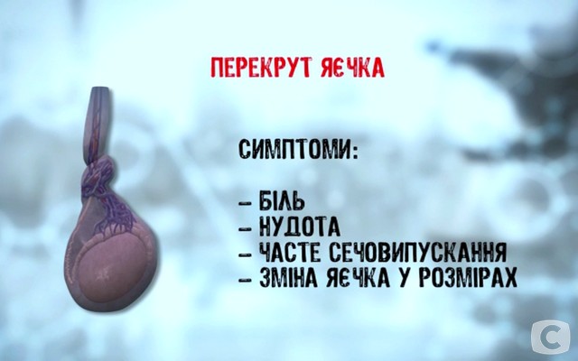 «Я соромлюсь свого тіла»-5: какие бывают заболевания мошонки? 2018-02-27_144556