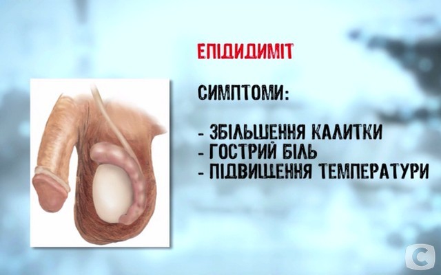 «Я соромлюсь свого тіла»-5: какие бывают заболевания мошонки? 2018-02-27_145211
