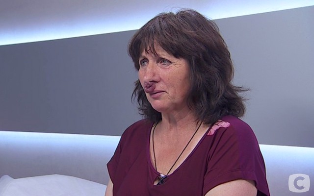 «Я соромлюсь свого тіла»-5 випуск 6: дівчину атакує власна нервова система 2018-03-05_110218