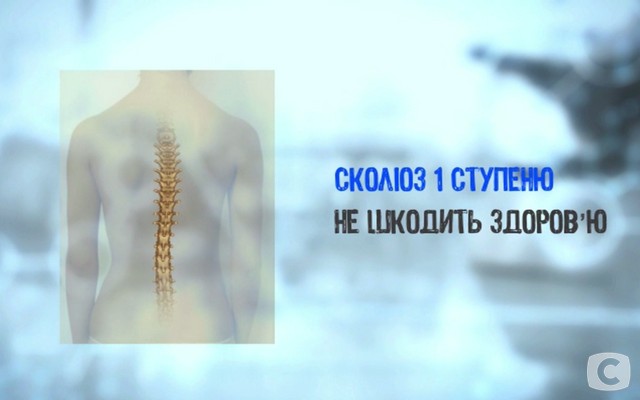 Что такое сколиоз и как его лечить 2018-04-02_131212
