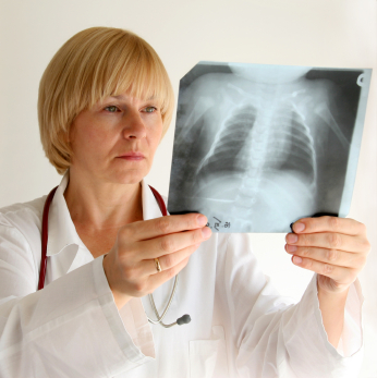 Як вилікувати туберкульоз? cough_chest_xray