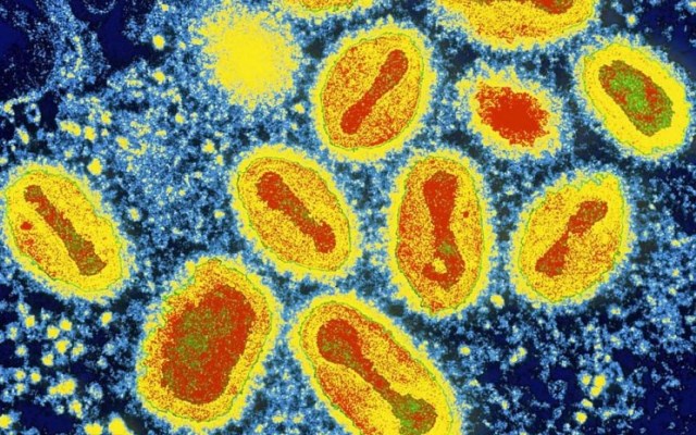 Як вилікувати папілому? skazochno-krasivye-izobrazheniya-smertelnyx-virusov-pod-mikroskopom-14-foto-video-obnovleno-virus-ospy-poxozhij-na-maslyanuyu-zhivopis_16524