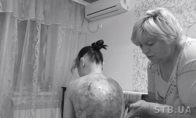 «Сюрприз, сюрприз!» зібрав близько 300 000 гривень для дівчини з «синдромом метелика» ав