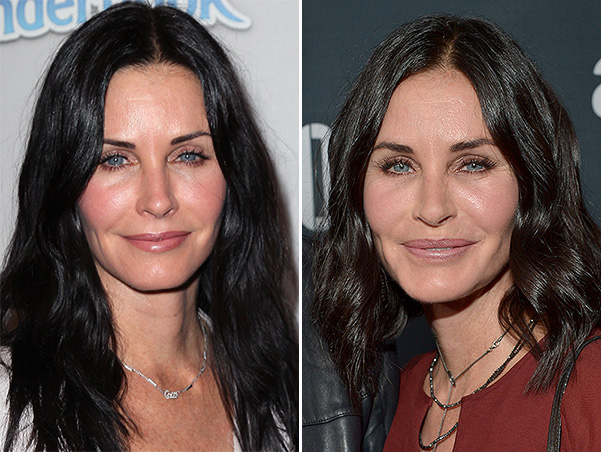 Звезда сериала «Друзья» сделала пластическую операцию? LOS ANGELES, CA - AUGUST 19: Actress Courteney Cox attends the Amazon premiere screening for original drama series "Hand Of God" at The Theatre at Ace Hotel on August 19, 2015 in Los Angeles, California. (Photo by Charley Gallay/Getty Images for Amazon Studios)