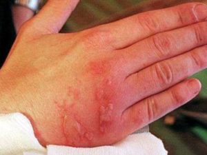 Чем опасны для зрения ребенка новомодные линзы?
